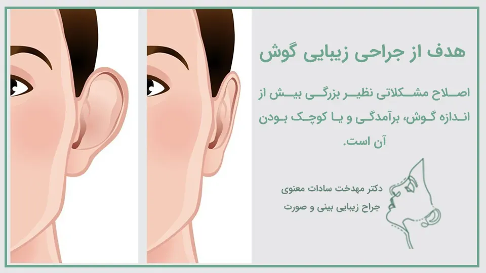 جراحی زیبایی گوش