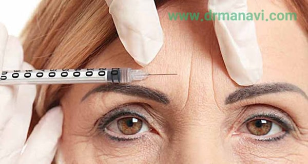 تزریق بوتاکس به پیشانی