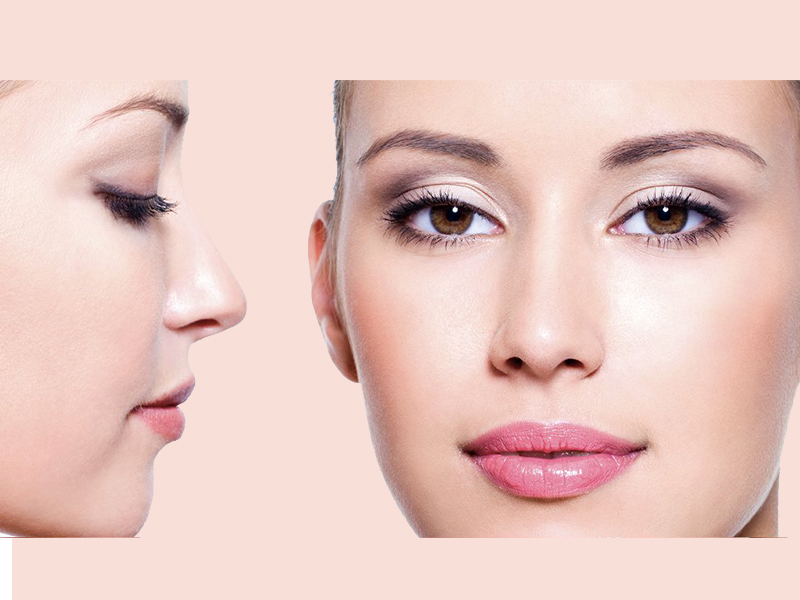 جراحی-بینی-طبیعی